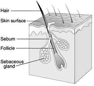 normal pilosebaceous unit