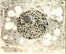 nucleolus