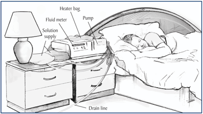 peritoneal dialysis cycler