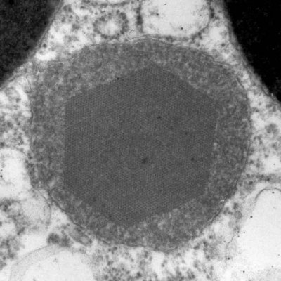 Transmission electron micrograph of a peroxisome from the marine snail Gibulla umbilicalis