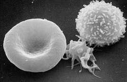 Scanning electron microscope image of a white blood cell, platelet, and red blood cell (NCI-Frederick)