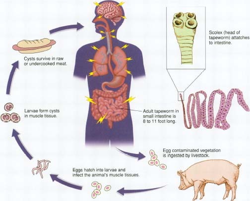 pork tapeworm life cycle