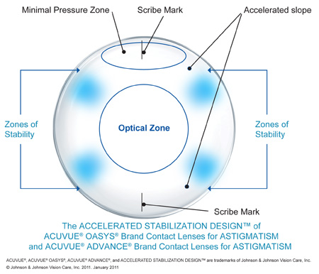 toric contact lens