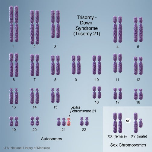 trisomy
