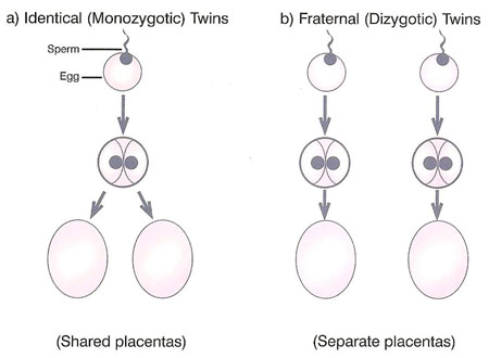 types of twins