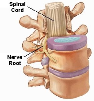 vertebrae and disks