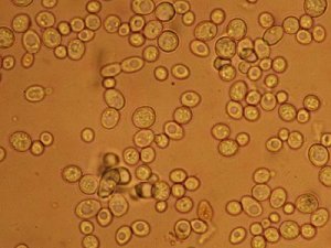 yeast cells