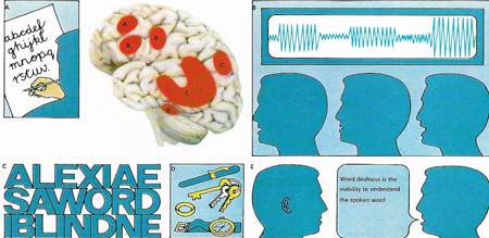 Language control areas in the brain are vital for several different functions.