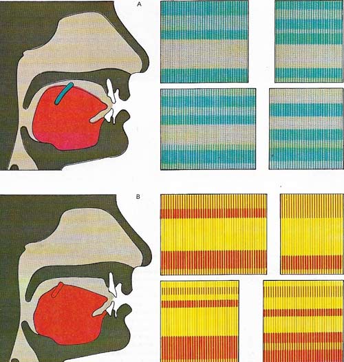 The sound spectrograph analyses the sound waves made by speech into component frequencies and intensities.