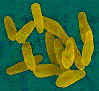 Corynebacterium diptheriae