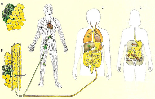 how cancer spreads