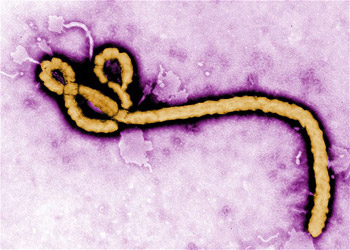 ebola virus