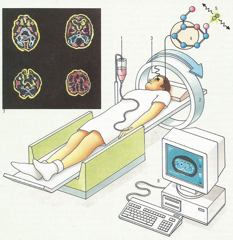 positron emission tomography