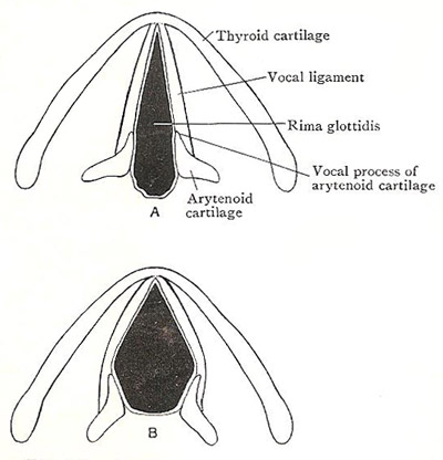 rima glottidis