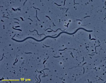 spirochaete