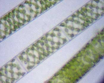 Spirogyra