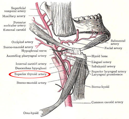 The superior thyroid artery in relation to the external 
            carotid and its branches