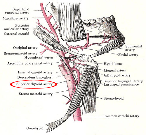 The superior thyroid artery in relation to the external
carotid and its branches