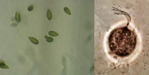 Mastigophora (flagellates) and some examples of their diversity.