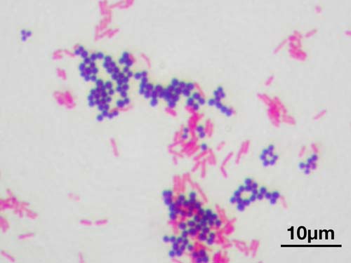 A Gram stain of mixed Staphylococcus aureus (S. aureus ATCC 25923, Gram-positive cocci, in purple) and Escherichia coli (E. coli ATCC 11775, Gram-negative bacilli, in red), the most common Gram stain reference bacteria.