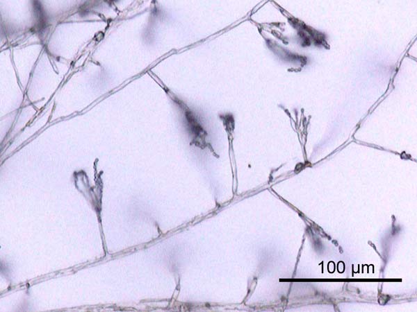 Hyphae of Penicillium.