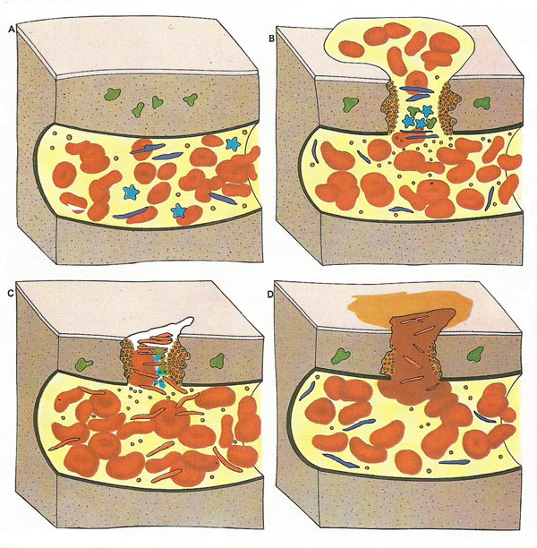 blood clotting