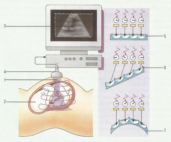 ultrasonics