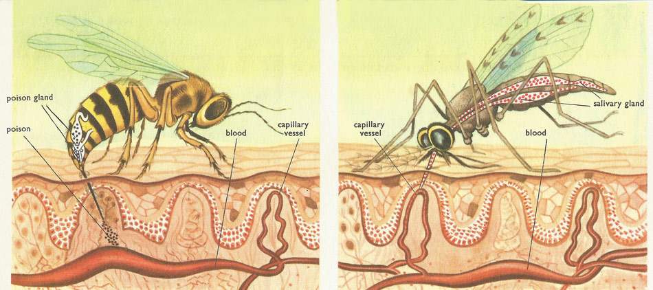 wasp sting and mosquito bite