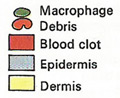 wound healing, key to diagram