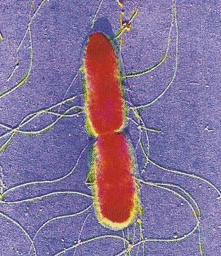 Salmonella typhi