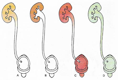 abnormal urine