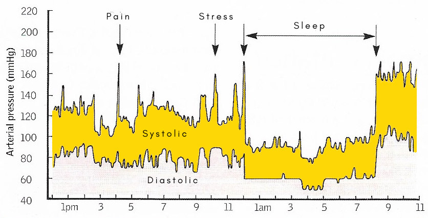 blood pressure variation 