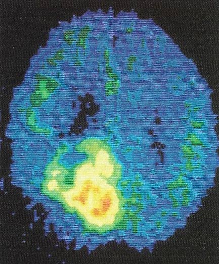 major parts of the brain