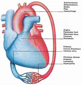 forms of cardiovascular disease