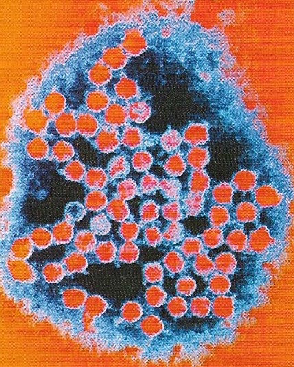 Micrograph of a rhinovirus