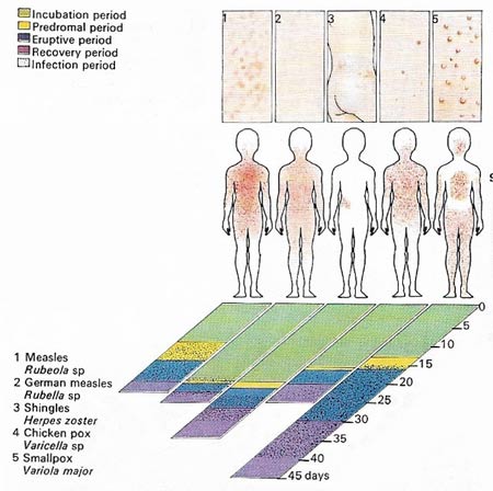 common viral diseases