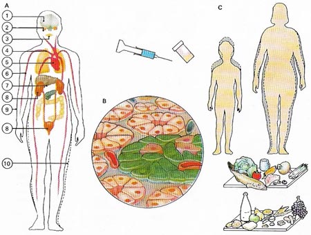 diabetes mellitus