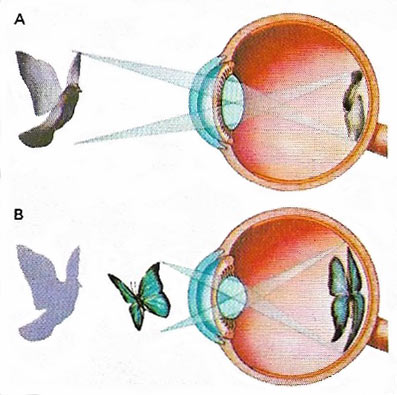 focusing of light by the eye