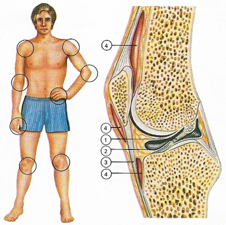 disorders of joints