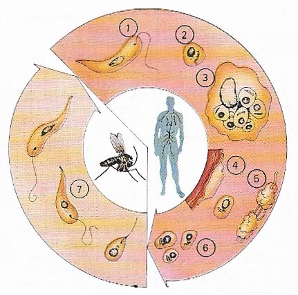 Leishmaniasis