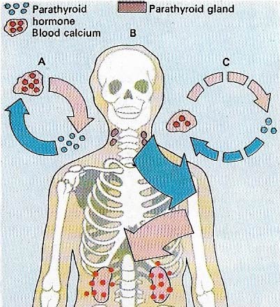 parathyroid overactivity