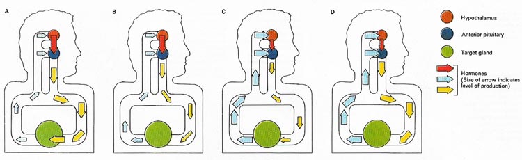 pituitary disorders