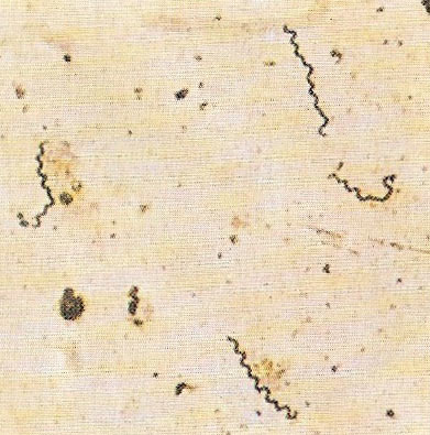 syphilis bacterium