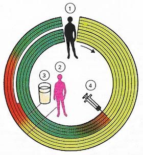 tuberculosis