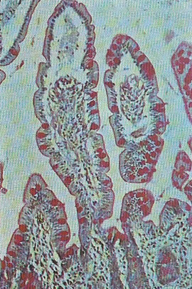 he villi are seen here in cross-section.