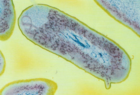 Shigella bacterium