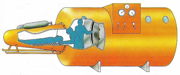 Submerged decompression chamber